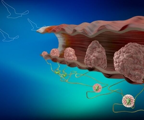 klinist- anal hpv taraması klinist- anal hpv taraması