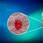 Ülseratif Kolit ve Crohn Farkı Nedir? Ameliyat Ne Zaman Gerekir? | Prof. Dr. İlknur Erenler Bayraktar