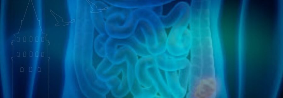 psödomiksoma peritonei nedir