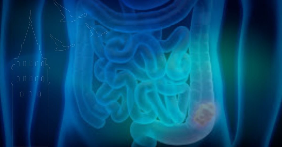 psödomiksoma peritonei nedir