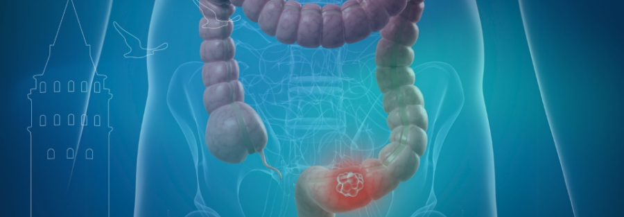 kolorektal nedir, karsinom ne demek