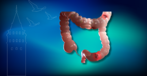 kolorektal kanser nedir