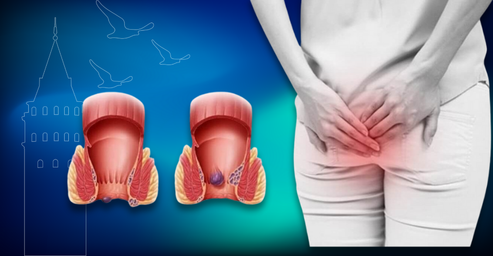 Kolonoskopi nedir, kolorektal kanser tarama