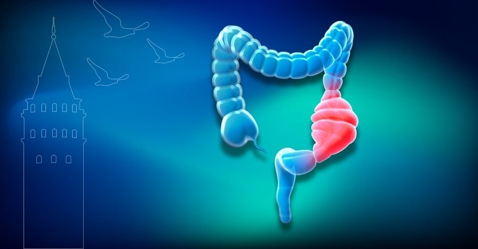Bağırsak Kanseri Belirtileri ve Erken Teşhis | Prof. Dr. İlknur Erenler