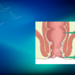 Anal HPV Taraması Nedir? | Prof. Dr. İlknur Erenler Bayraktar