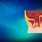 Rektal Prolapsus Nedir? Makat Sarkması Tedavisi | Prof. Dr. İlknur Erenler Bayraktar