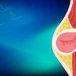 Fıtık Ameliyatı Sonrası Spor ve Ağır Kaldırma Ne Zaman? | Prof. Dr. İlknur Erenler Bayraktar